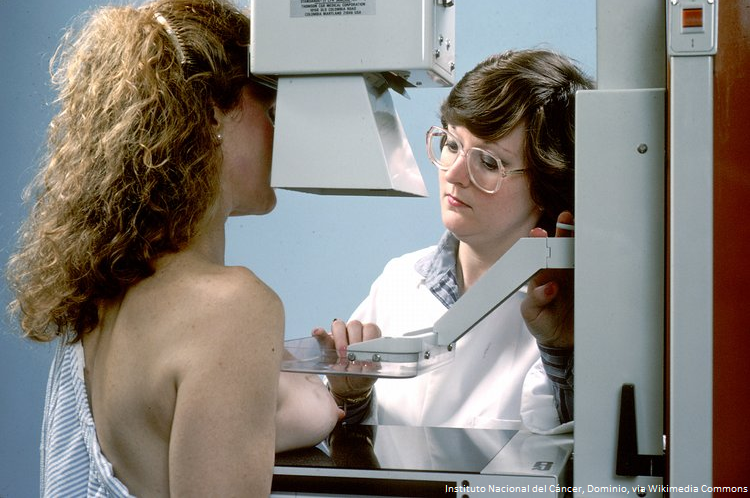 Reflexiones de una cincuentera…objetivo conseguido, mamografía realizada